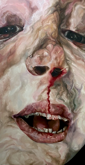 Reflection 1 (x)